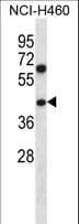 Polyclonal Rabbit anti-Human PUS1 Antibody (aa322-350, IHC, WB)