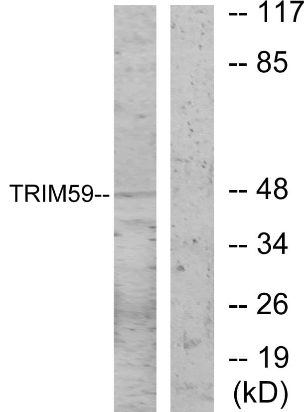 IHC-plus™ Polyclonal Rabbit anti-Human TRIM59 Antibody (aa191-240, IHC, IF, WB)