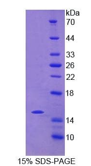 Human NCR2 / NKP44 Protein (Recombinant His-T7)