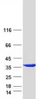 Human MPST Protein (Recombinant Myc-DDK (Flag))