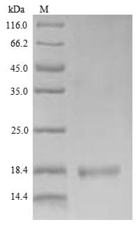 Mouse Ly6c1 Protein (Recombinant 6His, N-terminus)