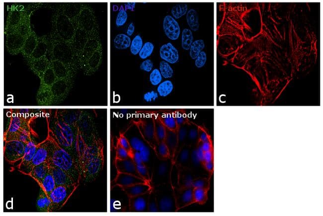 HK2 / Hexokinase 2 Antibody (clone 3D3)