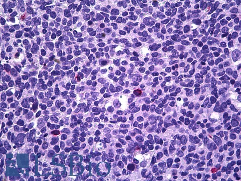 IHC-plus™ PPP3CA / CCN1 / Calcineurin A Antibody (aa21-51)