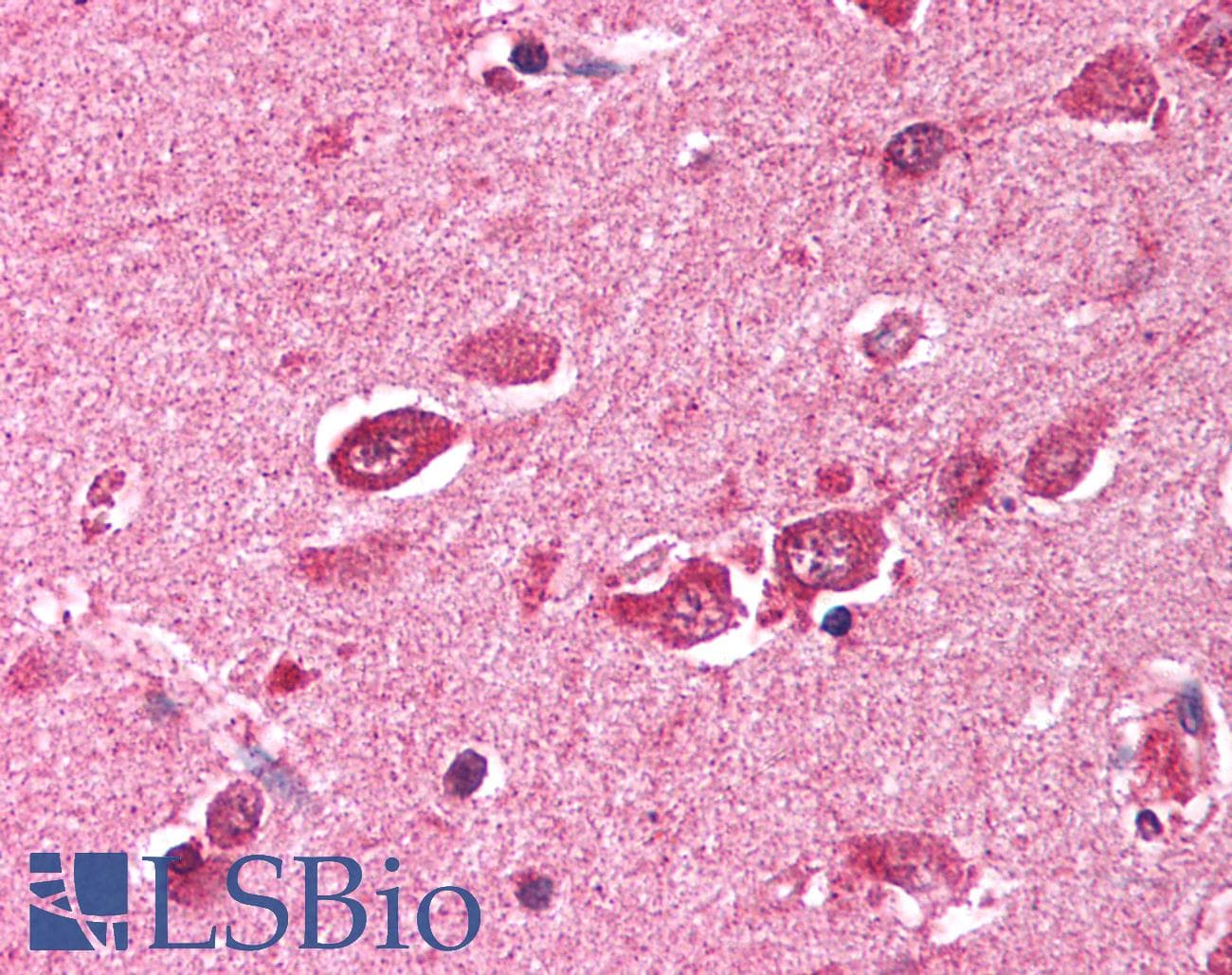 Polyclonal Rabbit anti-Human TRIM38 Antibody (C-Terminus, IHC, WB)