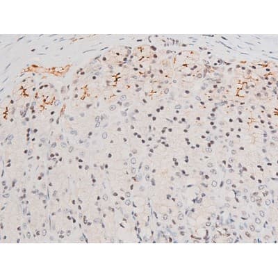 MAPK8 / JNK1 Antibody (phospho-Thr183,pTyr185)
