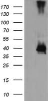 MAP2K3 / MEK3 / MKK3 Antibody (clone OTI3C3)