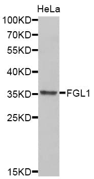 Polyclonal Rabbit anti-Human FGL1 / Hepassocin Antibody (IHC, WB)