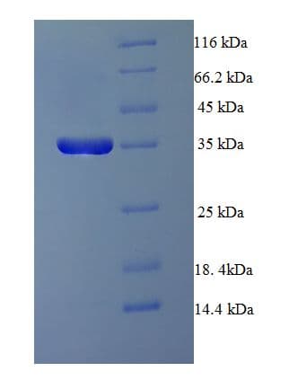 Human PPP2R3B Protein (Recombinant His-SUMO)