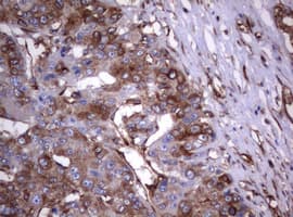 CD30 Antibody (clone OTI16H5)