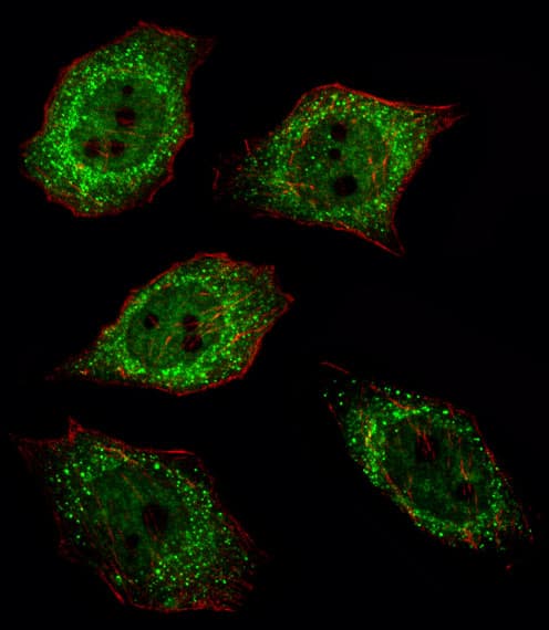 IHC-plus™ UCHL1 / PGP9.5 Antibody (aa187-214)