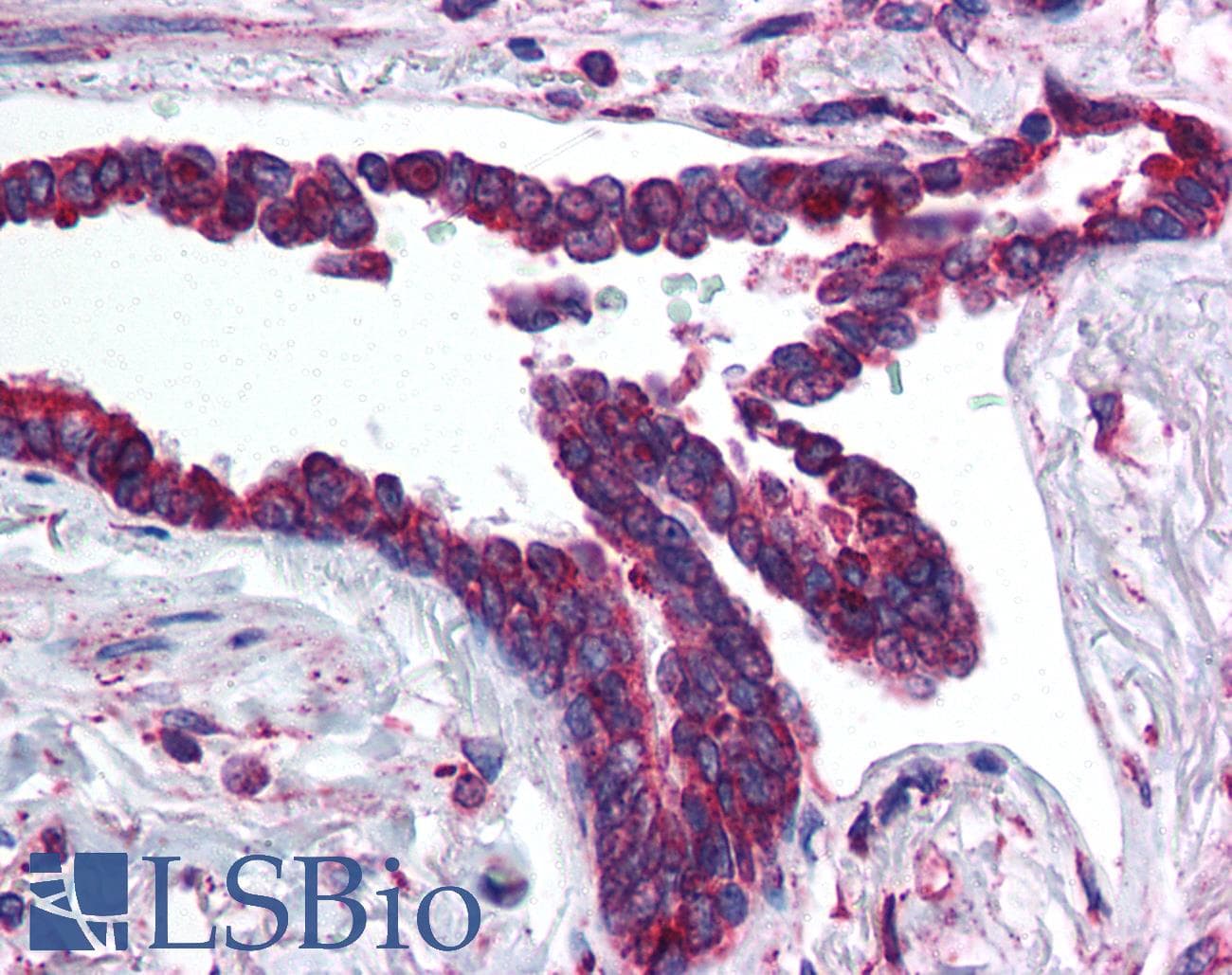IHC-plus™ HIF3A / HIF3-Alpha Antibody