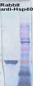 IHC-plus™ HSP40 Antibody
