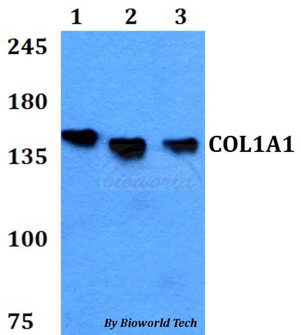Polyclonal Rabbit anti-Human COL1A1 / Collagen I Alpha 1 Antibody (WB)