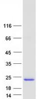 Human CYorf15A Protein (Recombinant Myc-DDK (Flag))