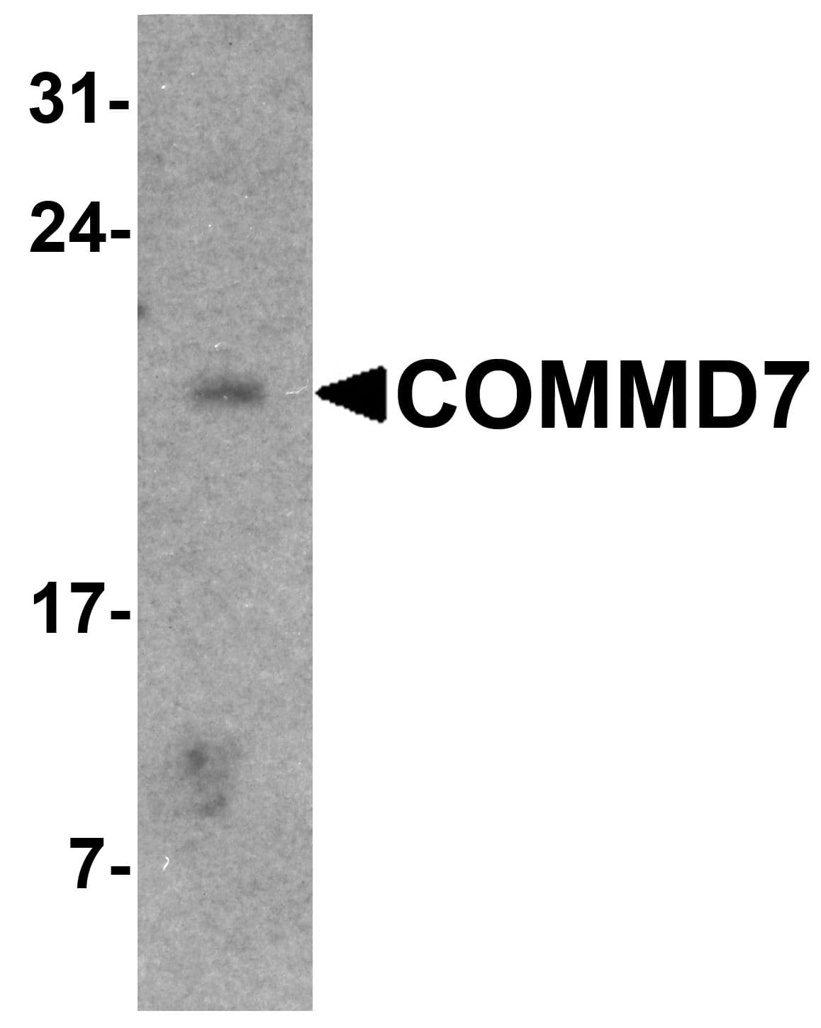 IHC-plus™ COMMD7 Antibody
