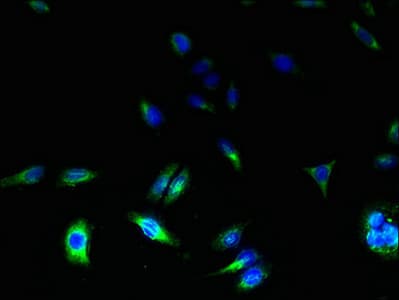 TSPAN31 Antibody (aa94-173)