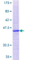 Human CYP2U1 Protein (Recombinant GST)