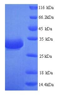 Bacteriophage T7 SSB Protein gp2.5 (Recombinant 6His, N-terminus)