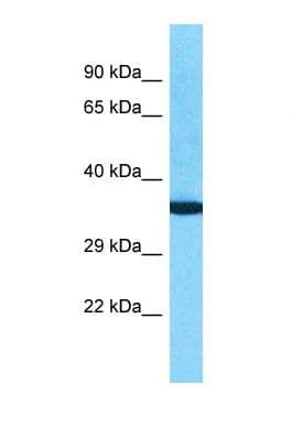 Polyclonal Rabbit anti-Human OR10K2 Antibody (aa242-291, WB)