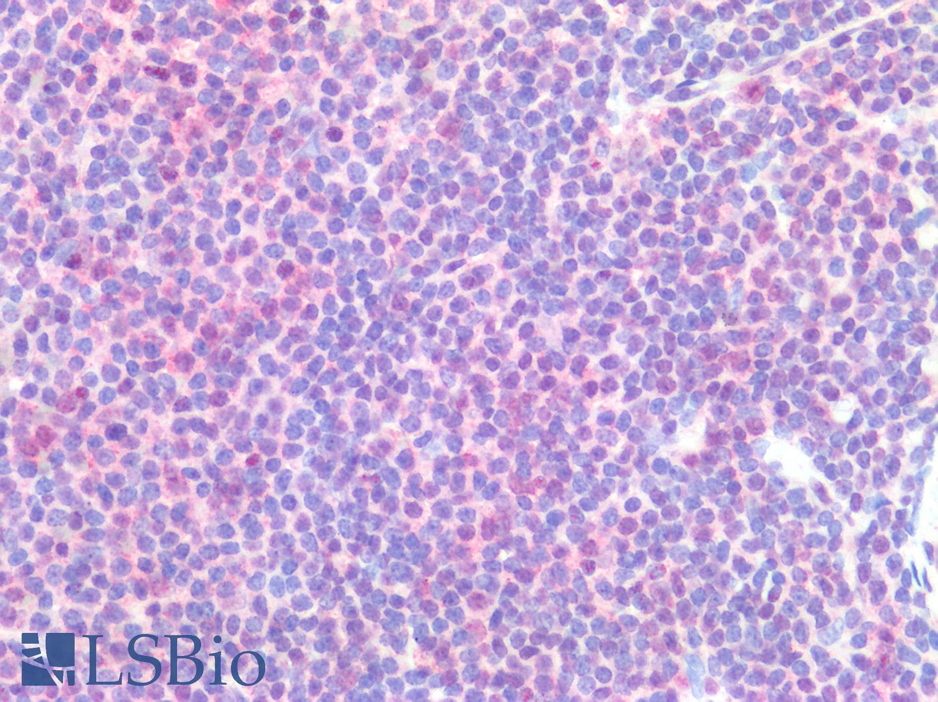 IHC-plus™ YWHAZ / 14-3-3 Zeta Antibody (Acetyl-Lys51/49)