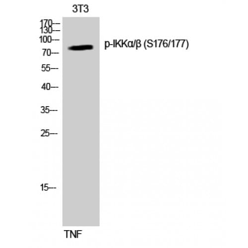 Polyclonal Rabbit anti-Human IKK Alpha+Beta Antibody (120-200 aa, IHC, WB)