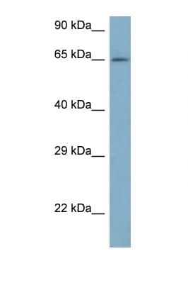 Polyclonal Rabbit anti-Human ARFGAP3 Antibody (aa91-140, WB)