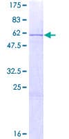 Human HOXB13 Protein (Recombinant GST)