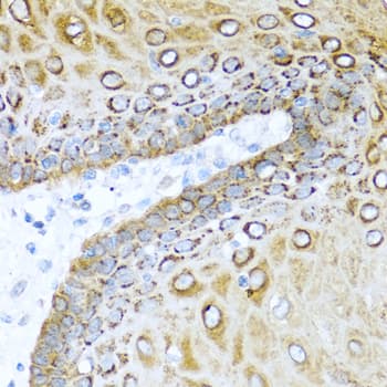 S100A7 / Psoriasin Antibody
