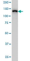 SF3B2 Antibody (clone 5D2)
