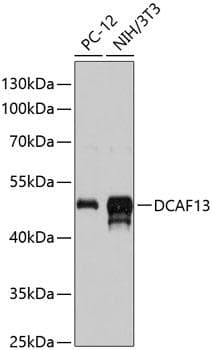Polyclonal Rabbit anti-Human DCAF13 / WDSOF1 Antibody (WB)