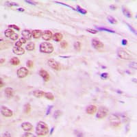 ALX3 Antibody (Internal)