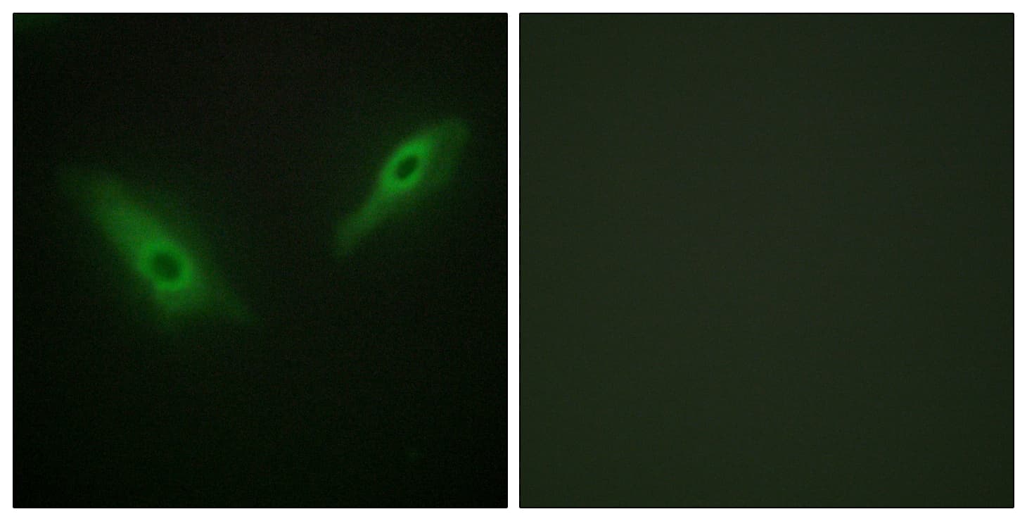 PHKA1 + PHKA2 Antibody (N-Terminus)