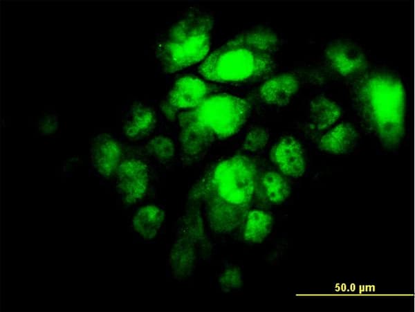 Monoclonal Mouse anti-Human IRF5 Antibody (clone 2D4, IHC, IF, WB)
