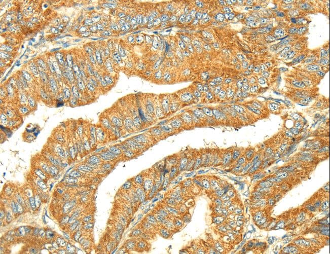Polyclonal Rabbit anti-Human GALK1 / GK1 Antibody (IHC)