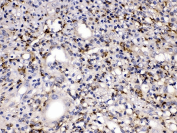 Polyclonal Rabbit anti-Human MMP11 Antibody (IHC, WB)