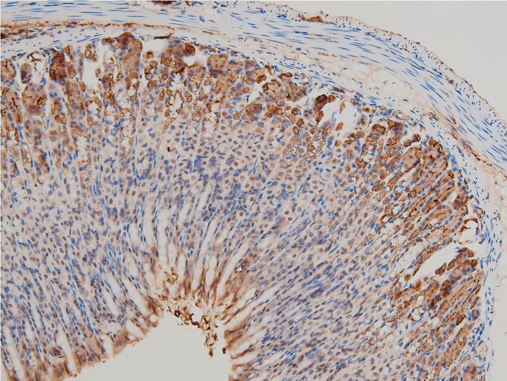 LIMK1 / LIMK Antibody (phospho-Thr508)