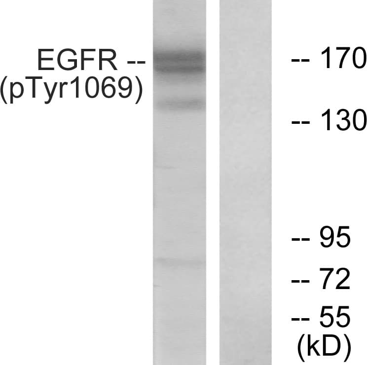 EGFR Antibody (phospho-Tyr1069)