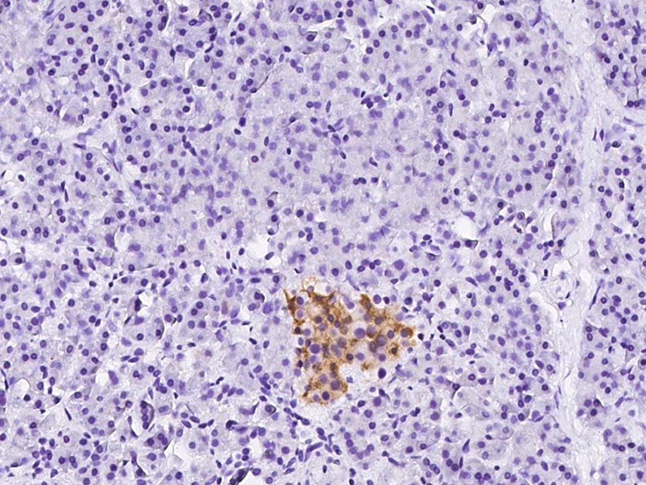 ATP6AP2 / Renin Receptor Antibody