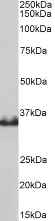 IHC-plus™ LDHB / Lactate Dehydrogenase B Antibody (aa297-310)