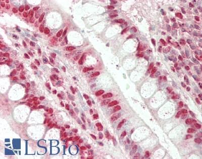 IHC-plus™ CCND2 / Cyclin D2 Antibody