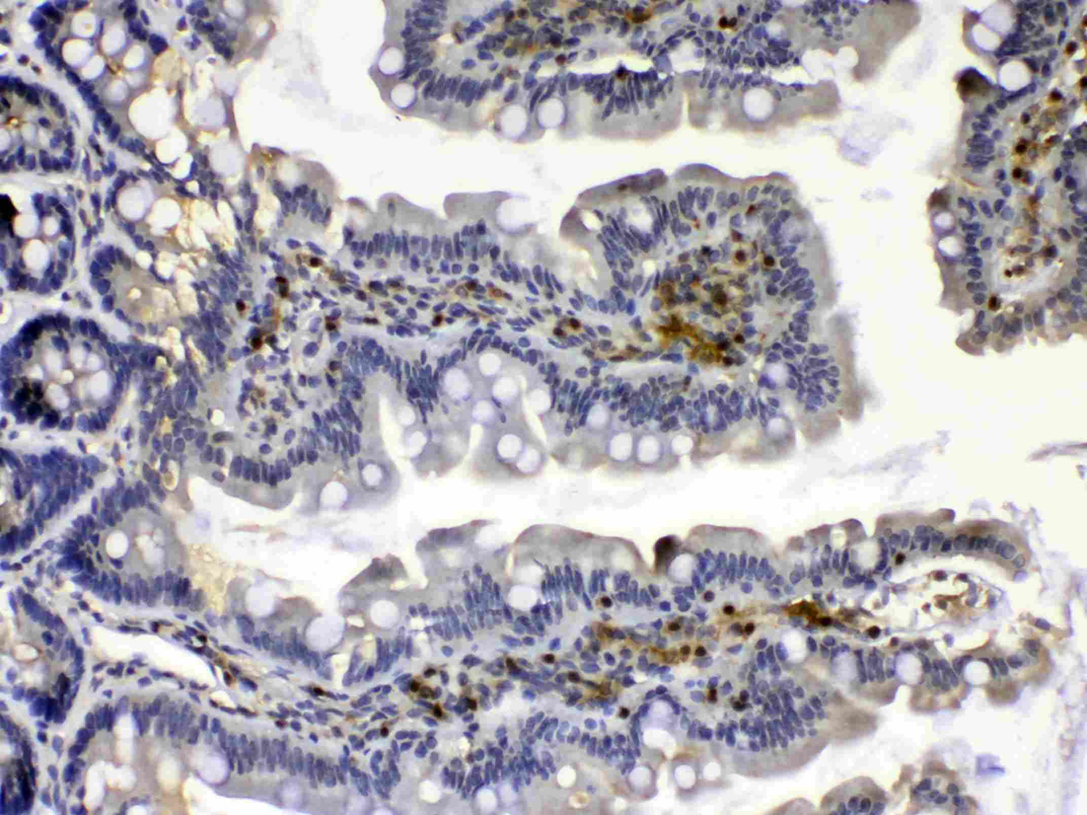 CAPN2 / Calpain 2 / M-Calpain Antibody