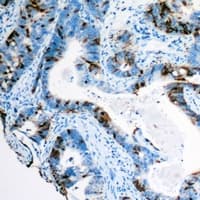 SDC1 / Syndecan 1 / CD138 Antibody