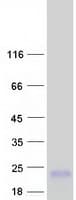 Human MT1A / Metallothionein 1A Protein (Recombinant Myc-DDK (Flag))