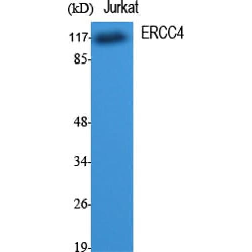 ERCC4 / XPF Antibody (770-850 aa, C-terminal)