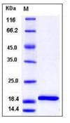 Mouse IL-1B / IL-1 Beta Protein (Recombinant)