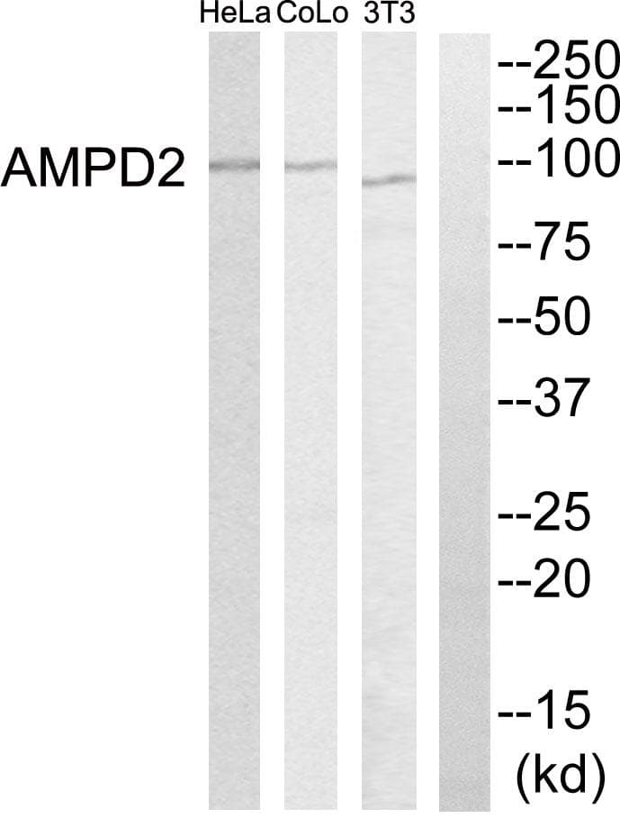 Polyclonal Rabbit anti-Human AMPD2 Antibody (WB)