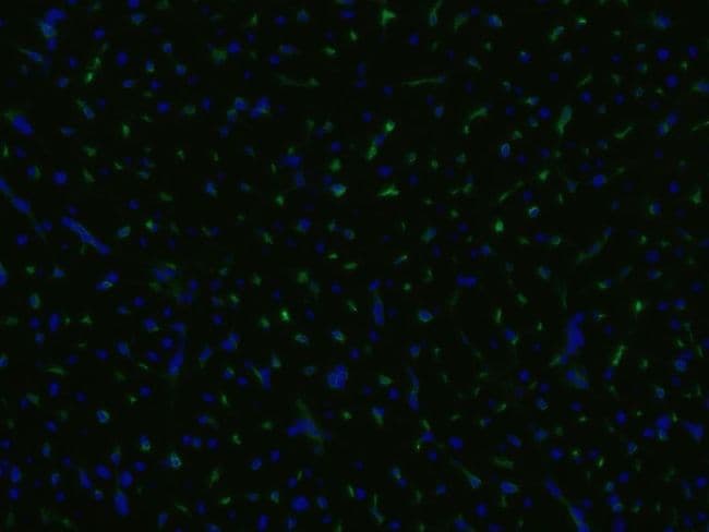 CD105 Antibody (clone MEM-229)