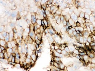 SLC2A2 / GLUT2 Antibody