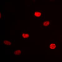 Polyclonal Rabbit anti-Human HNRNPD / AUF1 Antibody (Internal, IHC, IF, WB)