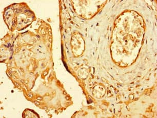 Polyclonal Rabbit anti-Human RNF4 Antibody (IHC, IF)